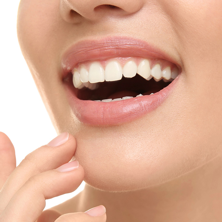 Woman showing improved smile after dental bonding in Stafford, VA