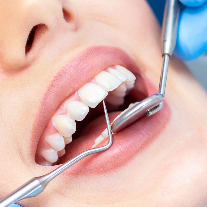 Ceramic Dental Implants Stafford VA